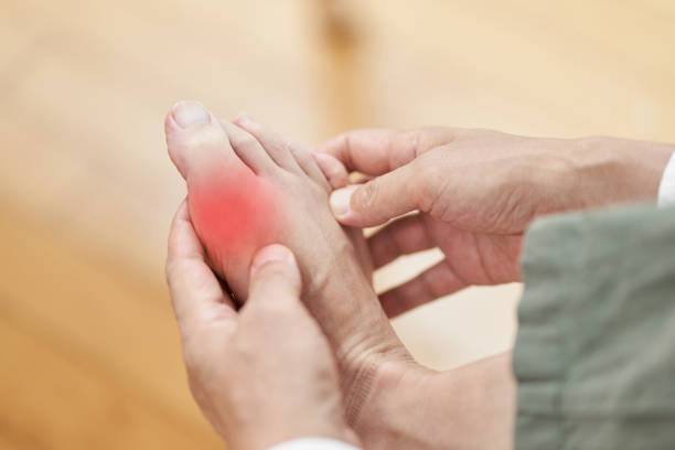 When To See A Gout Specialist In Whittier And How To Find The Best Rheumatoid Arthritis Doctor In Whittier